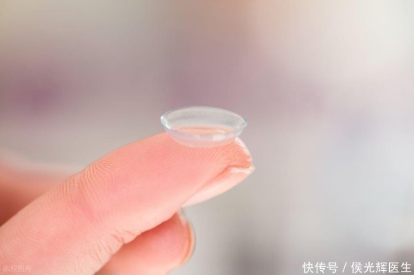 鑫恒盈配资 眼睛总是很痒，咋回事？是干眼症？医生：这4类疾病或是源头！